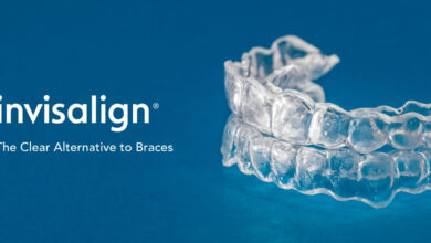 Photo of Do’s And Don’ts of Invisalign